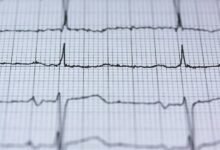 neural hyper beam technology